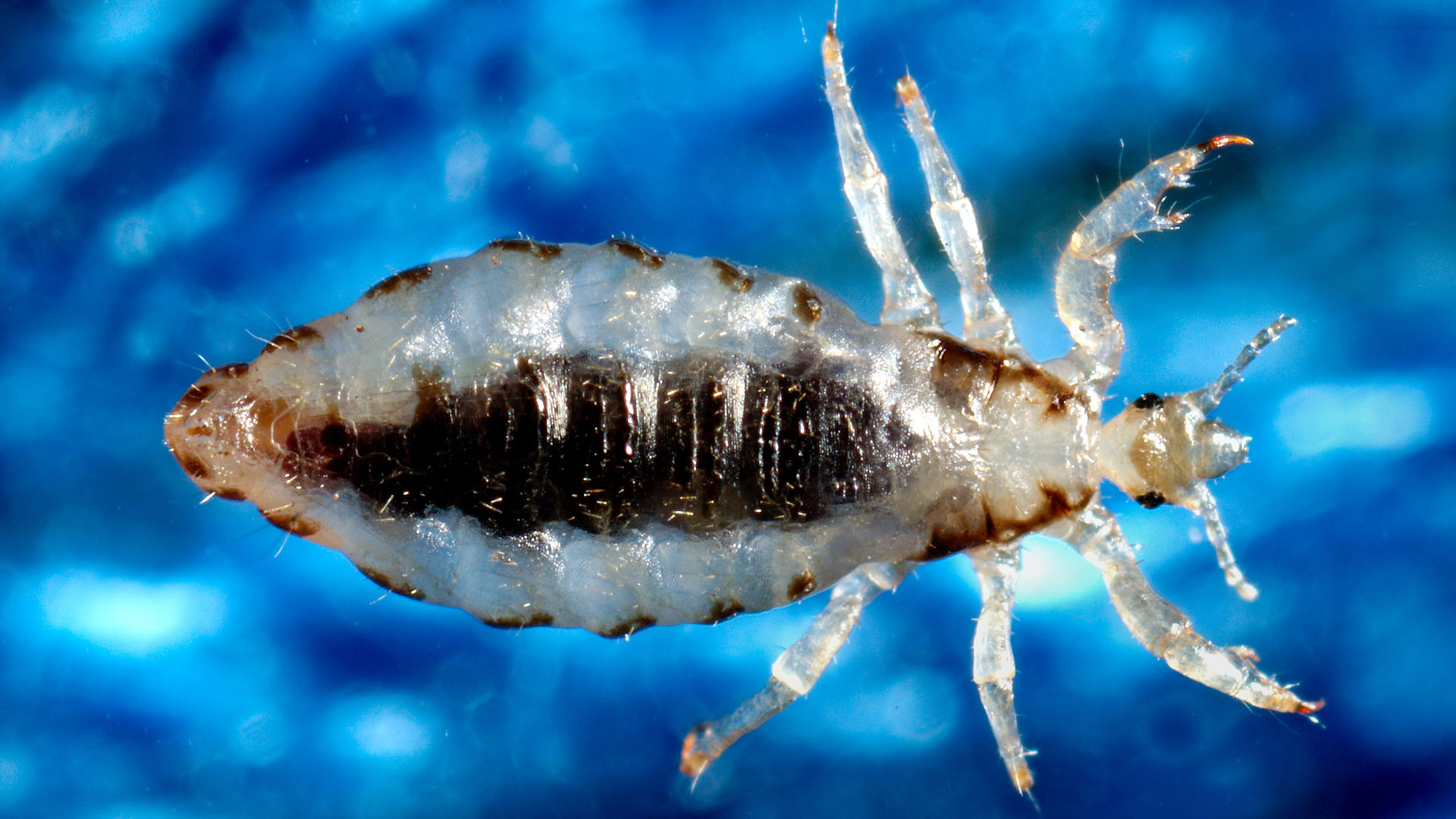 Pediculus humanus.